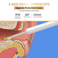 NE3 Ear Cleaner Otoscope Ear Wax Removal Tool With Camera LED Light Wireless Ear Endoscope Ear Cleaning Kit For I-phone | Everyday Home Deal