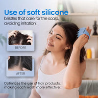 Hair Scalp Massager – Shampoo Brush Exfoliator