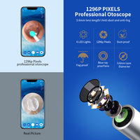 NE3 Ear Cleaner Otoscope Ear Wax Removal Tool With Camera LED Light Wireless Ear Endoscope Ear Cleaning Kit For I-phone | Everyday Home Deal
